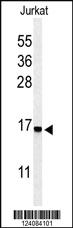 Anti-RPS25 Rabbit Polyclonal Antibody