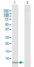 Anti-CCL18 Rabbit Polyclonal Antibody