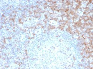 Immunohistochemical analysis of formalin-fixed, paraffin-embedded human tonsil tissue using Anti-CD5 Antibody [rC5/6462]