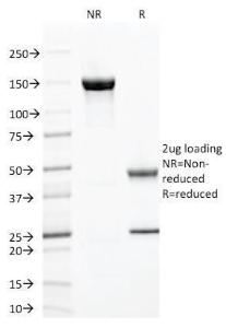 Antibody anti-ZAP70 ZAP702047 100 µg