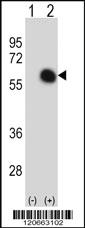 Anti-GATA2 Rabbit Polyclonal Antibody