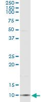 Anti-CCL18 Mouse Monoclonal Antibody [clone: 2C6]