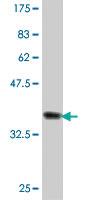 Anti-ACTN1 Mouse Polyclonal Antibody