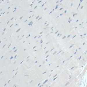 Immunohistochemistry analysis of paraffin-embedded rat heart using Anti-GAPDS Antibody (A11323) at a dilution of 1:100 (40X lens). Perform microwave antigen retrieval with 10 mM PBS buffer pH 7.2 before commencing with IHC staining protoco