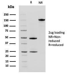 SDS-PAGE analysis of Anti-CD10 Antibody [MME/2580] under non-reduced and reduced conditions; showing intact IgG and intact heavy and light chains, respectively SDS-PAGE analysis confirms the integrity and purity of the antibody