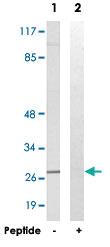 Anti-ELOVL5 Rabbit Polyclonal Antibody