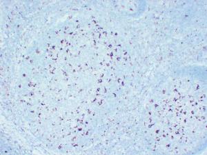 Immunohistochemical analysis of paraffin-embedded human Tonsil using Anti-CD68 Antibody