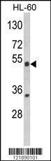 Anti-Pregnane X Receptor Rabbit Polyclonal Antibody (APC (Allophycocyanin))