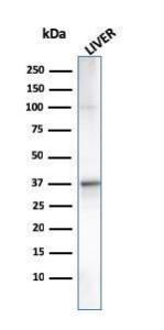 Western blot analysis of human liver tissue lysate using Anti-C1QA Antibody [C1QA/2955]