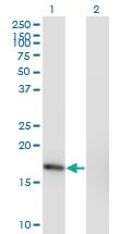 Anti-SNX3 Mouse Monoclonal Antibody [clone: 3A9]