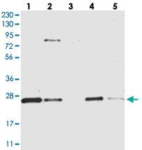 Anti-CCDC90B Rabbit Polyclonal Antibody