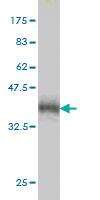 Anti-PRKAA1 Mouse Monoclonal Antibody [clone: 1G4]