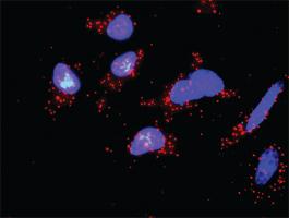 Anti-OCLN + CSNK1E Antibody Pair