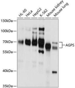 Anti-AGPS Antibody (A11325)