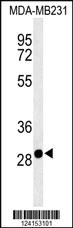 Anti-SLC25A37 Rabbit Polyclonal Antibody