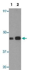 Anti-IDH1 Rabbit Polyclonal Antibody