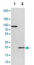 Anti-CCDC90B Rabbit Polyclonal Antibody