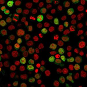 Antibody anti-ZAP70 ZAP702047 100 µg