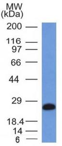 Anti-CD79a Mouse Monoclonal Antibody [clone: IGA/1406]