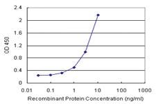 Anti-COMMD1 Antibody Pair