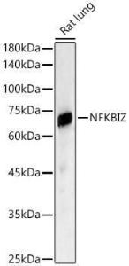 Western blot analysis of Rat lung, using Anti-IKB zeta Antibody (A11326) at 1:2,000 dilution. The secondary antibody was Goat Anti-Rabbit IgG H&L Antibody (HRP) at 1:10,000 dilution.