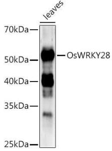 Western blot analysis of extracts of various tissues from the japonica rice (Oryza sativa L. ) variety Zhonghua 11, using Anti-WRKY28-LIKE Antibody (A309747) at 1:1,000 dilution. The secondary antibody was Goat Anti-Rabbit IgG H&L Antibody (HRP) at 1:10,000 dilution.