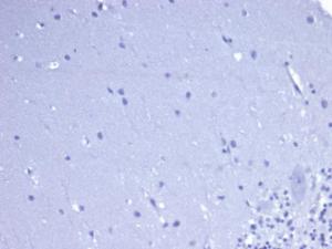 Negative Tissue Control: Immunohistochemical analysis of formalin-fixed, paraffin-embedded human brain using Anti-CD5 Antibody [rC5/6462] at 2 µg/ml in PBS for 30 minutes at room temperature