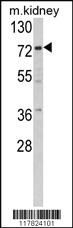 Anti-VIL1 Rabbit Polyclonal Antibody