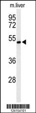 Anti-ZDHHC9 Rabbit Polyclonal Antibody