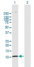 Anti-SMAD3 Rabbit Polyclonal Antibody