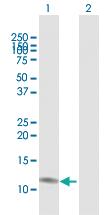 Anti-CCL23 Rabbit Polyclonal Antibody