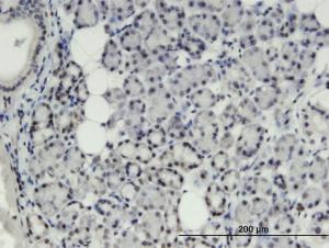 Anti-THRSP Mouse Monoclonal Antibody [clone: 2F8]