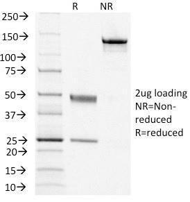 Anti-CD79a Mouse Monoclonal Antibody [clone: IGA/1406]