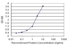 Anti-COMMD1 Polyclonal Antibody Pair