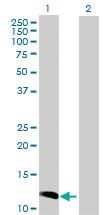 Anti-CCL23 Rabbit Polyclonal Antibody