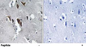 Anti-ELOVL5 Rabbit Polyclonal Antibody