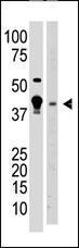 Anti-MBD2 Rabbit Polyclonal Antibody (APC (Allophycocyanin))