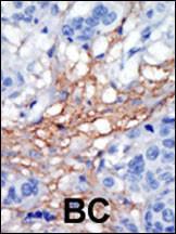 Anti-PIP5K1C Rabbit Polyclonal Antibody (Biotin)