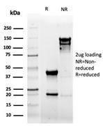 SDS-PAGE analysis of Anti-CD5 Antibody [rC5/6462] under non-reduced and reduced conditions; showing intact IgG and intact heavy and light chains, respectively SDS-PAGE analysis confirms the integrity and purity of the antibody