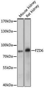 Anti-Frizzled 6 antibody