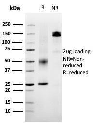 SDS-PAGE analysis of Anti-SERBP1 Antibody [SERBP1/3495] under non-reduced and reduced conditions; showing intact IgG and intact heavy and light chains, respectively. SDS-PAGE analysis confirms the integrity and purity of the antibody.