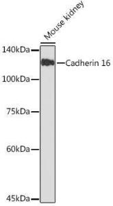 Western blot analysis of extracts of Mouse kidney, using Anti-Cadherin 16 Antibody [ARC2212] (A305939) at 1:1000 dilution