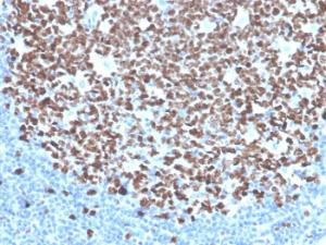 Immunohistochemical analysis of formalin-fixed, paraffin-embedded human tonsil using Anti-Ki67 Antibody [MKI67/4945R]