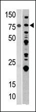 Anti-PRKAG1 Rabbit Polyclonal Antibody