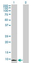 Anti-CXCL6 Rabbit Polyclonal Antibody