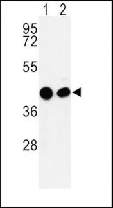 Anti-OAT Rabbit Polyclonal Antibody (Biotin)