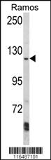 Anti-AAK1 Rabbit Polyclonal Antibody