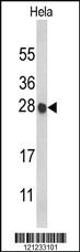 Anti-HIST1H1C Rabbit Polyclonal Antibody