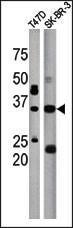 Anti-ICMT Rabbit Polyclonal Antibody (AP (Alkaline Phosphatase))