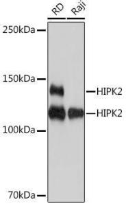 Anti-HIPK2 Rabbit Monoclonal Antibody [clone: ARC1631]